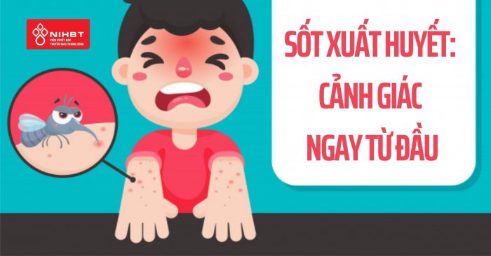 Sot xuat huyet tieng anh